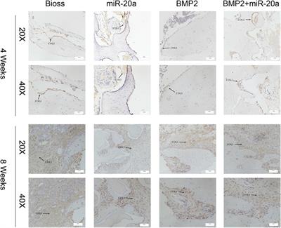 MiR-20a promotes osteogenic differentiation in bone marrow-derived mesenchymal stem/stromal cells and bone repair of the maxillary sinus defect model in rabbits